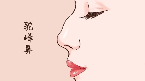 鼻部整形效果怎么樣