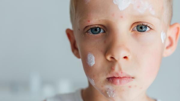 臉部下垂能自然恢復(fù)嗎 臉部下垂的3個(gè)恢復(fù)方法揭曉