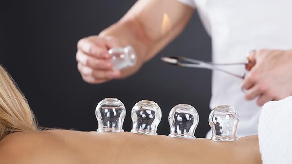 拔罐后的正常反應(yīng)有哪些