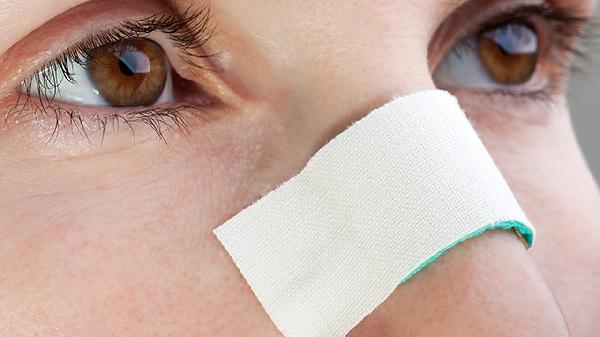 一個月嬰兒鼻子不通氣怎么辦