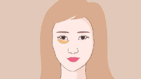 淚溝填充兩條棱一直消不掉怎么回事，怎么辦