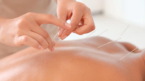 埋線減肥掛什么科室廣安門中醫(yī)院