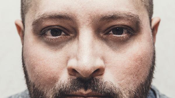 男人黑眼圈眼袋很重怎么辦