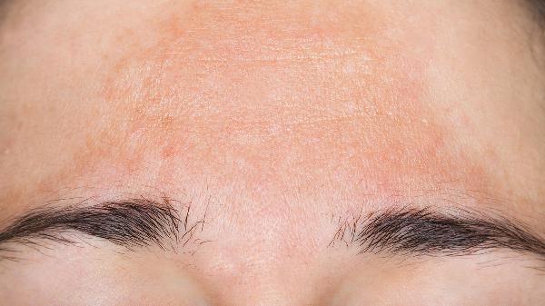 背部有小块白色斑块是怎么回事