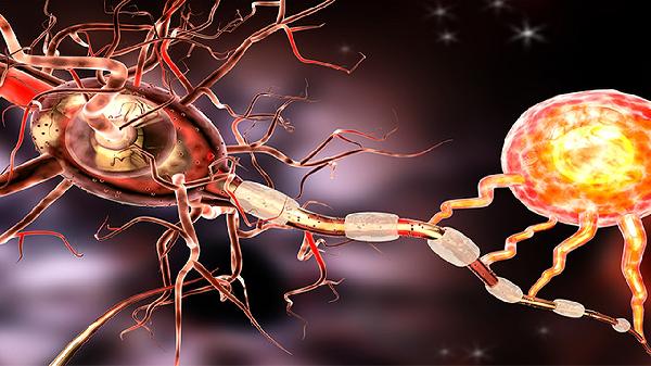 肋間神經(jīng)炎的注意事項有哪些