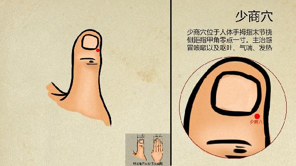 穴位埋線的適用人群有哪些