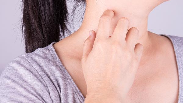 扁平疣是看中醫好還是西醫好