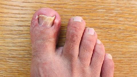 從小喜歡咬指甲是什么原因