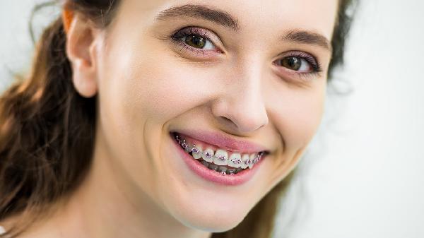 牙齒矯正35歲還可以嗎