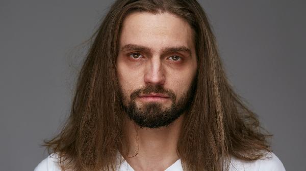 激光去除色素型黑眼圈