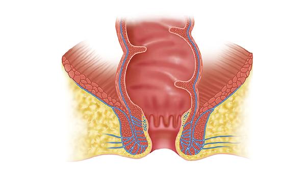 臀部?jī)蓚?cè)肉多是什么原因