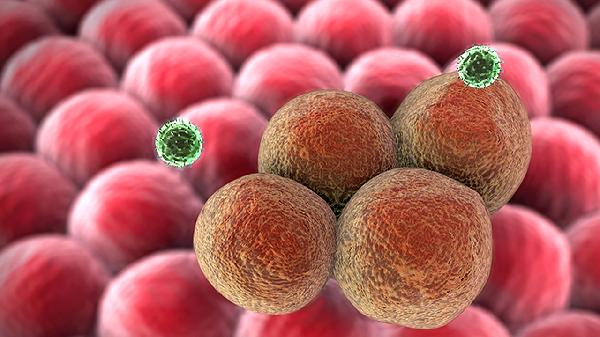 尿常規(guī)細(xì)菌多怎么辦