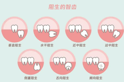 智齒是怎么形成的