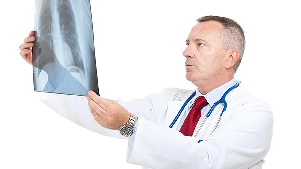 肺纖維化的原因是什么