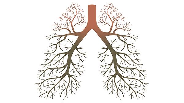 肺動(dòng)靜脈瘺的治療方法