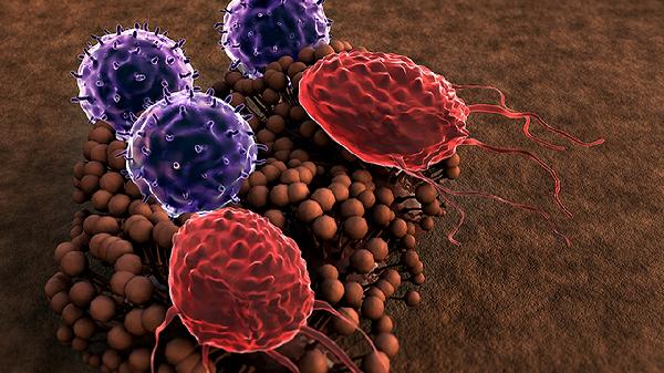 胃角腺癌的治療