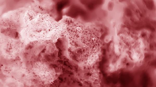 腎上囊腫是什么病