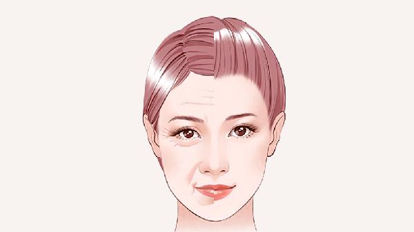 下眼瞼松弛的治療方法