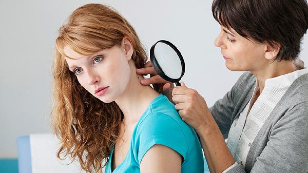 容易過敏的皮膚女性如何護理