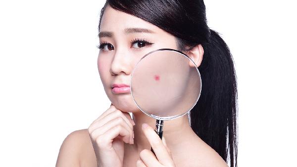 青春痘黑眼圈的臉為什么有問題