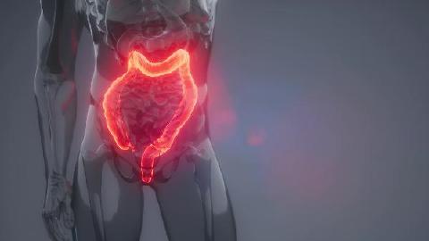 潰瘍性結腸炎的癥狀是什么