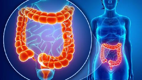 結(jié)腸癌病理病因介紹