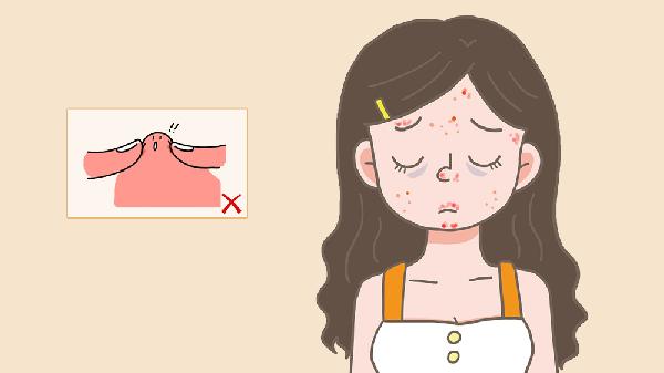 為什么背上長(cháng)痘痘