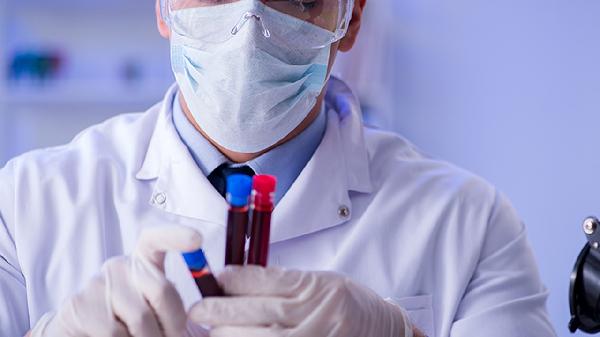 结肠黑变病的治疗方法