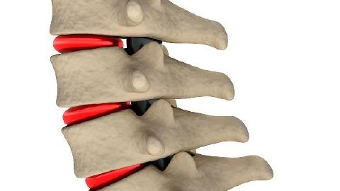 多發(fā)性骨髓瘤易誤診的原因