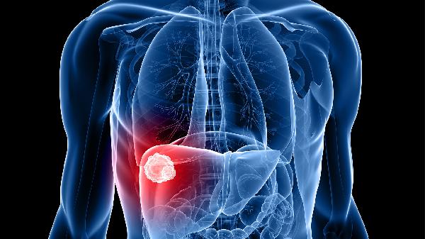 生活中如何遠(yuǎn)離慢性肝炎