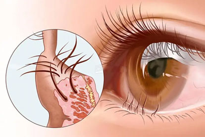 一天掉多少睫毛是正常的