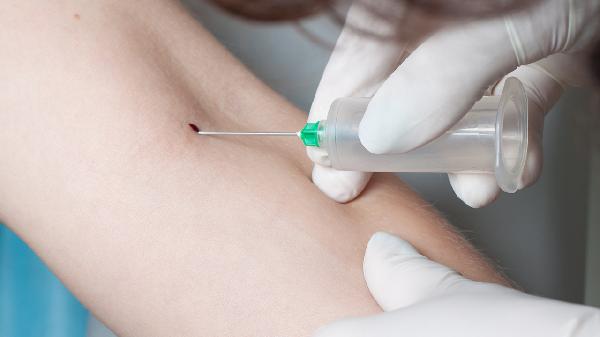 兒童期血脂增高的干預(yù)原則