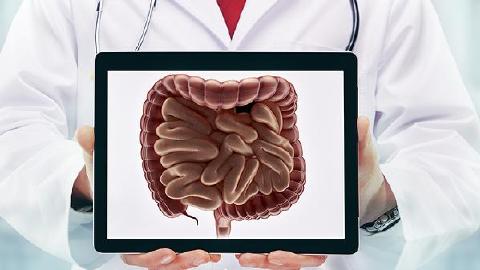 直肠息肉的最佳防卫措施