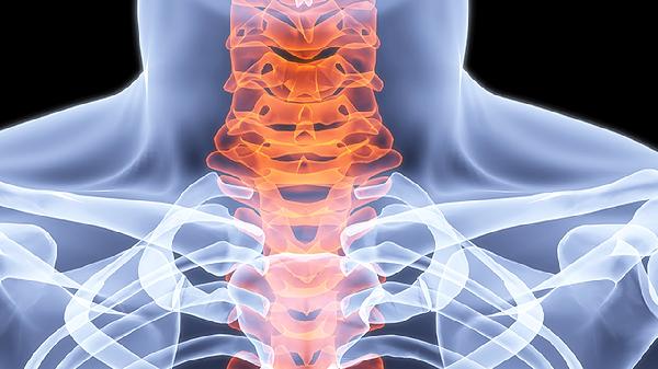 注重多發(fā)性骨髓瘤的預(yù)防