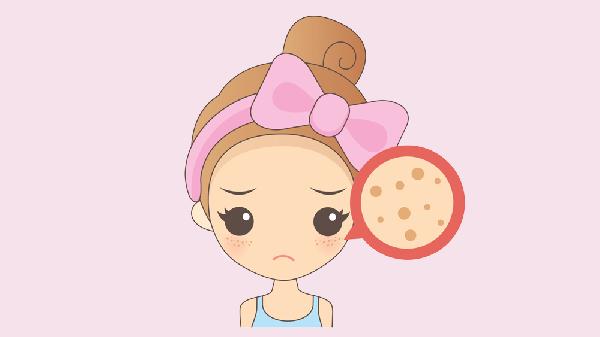 祛雀斑的幾個(gè)誤區要慎重