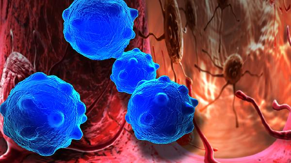 白塞氏病不會(huì )遺傳