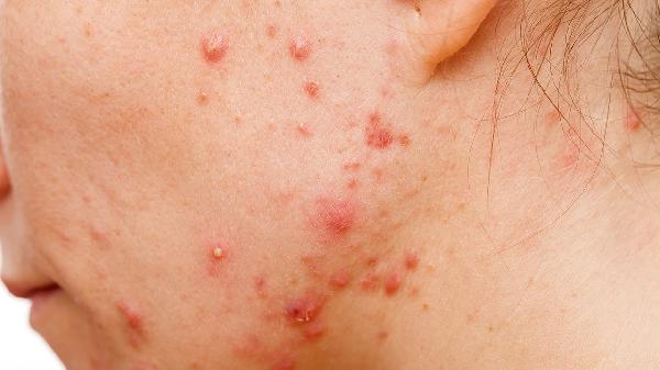 眼底黃斑的治療方法