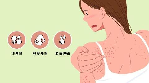 梅毒患者在生活中也要特別注意