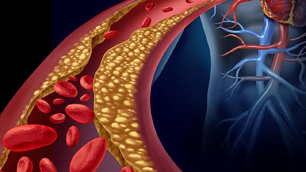 每天一個(gè)改變，讓血管更年輕！