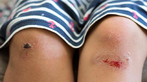 小腿脂肪吸收手術(shù)的價(jià)格是多少