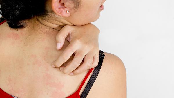 血小板减少性紫癜的危害