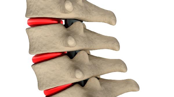 多發(fā)性骨髓瘤的護(hù)理
