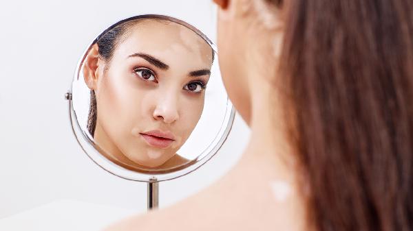 白癜風(fēng)的恢復需要記住三個(gè)護理原則