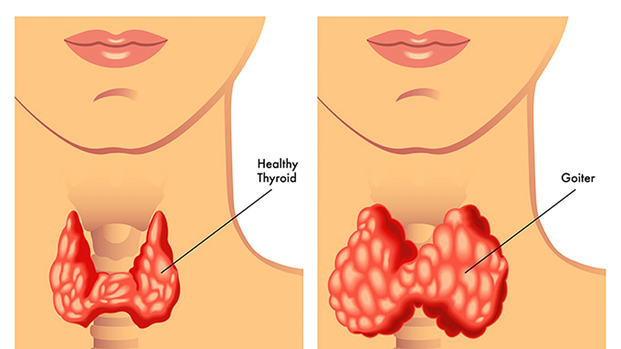胃里老有气顶上喉咙是什么原因