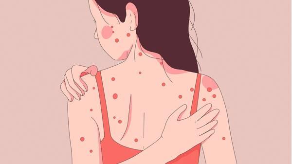 皮膚科都治什么皮膚病