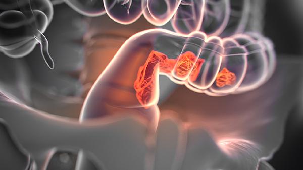 硫酸鎂對(duì)腸道的作用