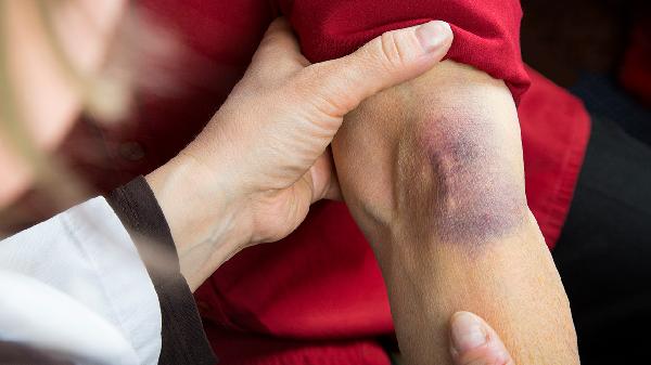 陰部被舔腫脹了怎么處理