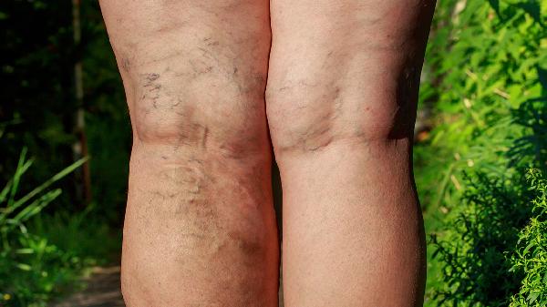 膝蓋軟骨修復手術(shù)多少錢(qián)