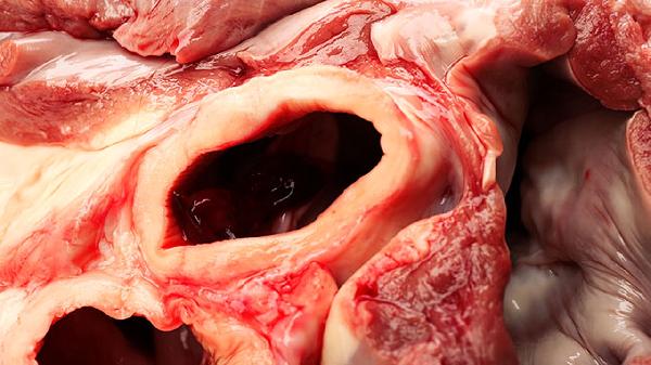 左旋肉堿的副作用與危害性