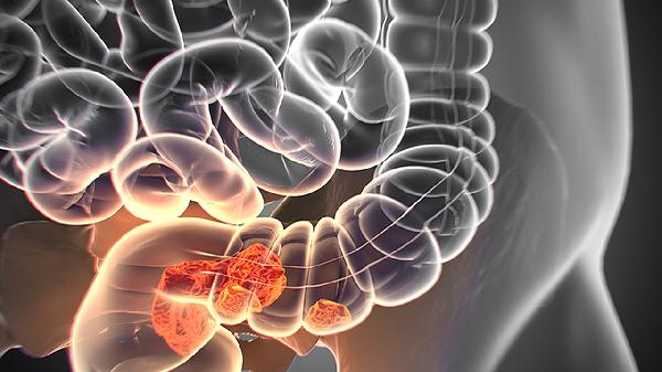 做腸鏡一般過(guò)程是怎樣的